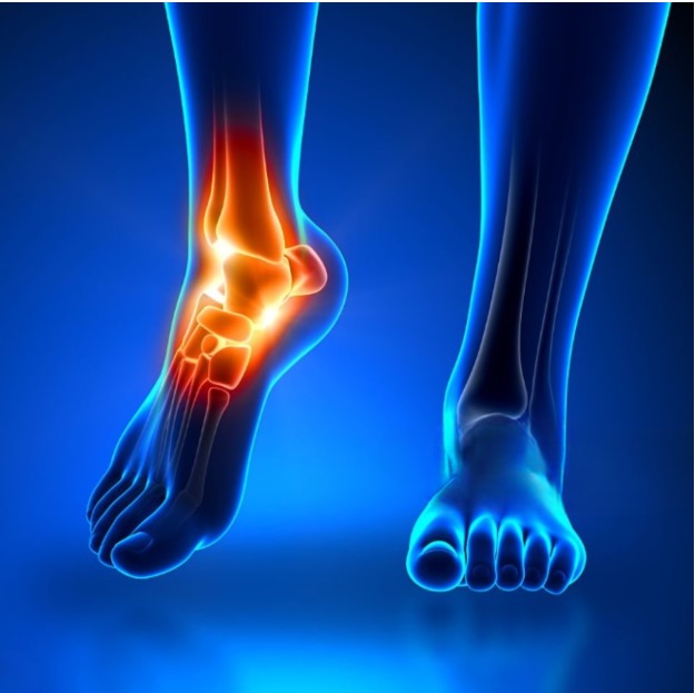 Arch Support Insoles showcasing a white and blue insole design, offering comfort and stability for foot pain relief.